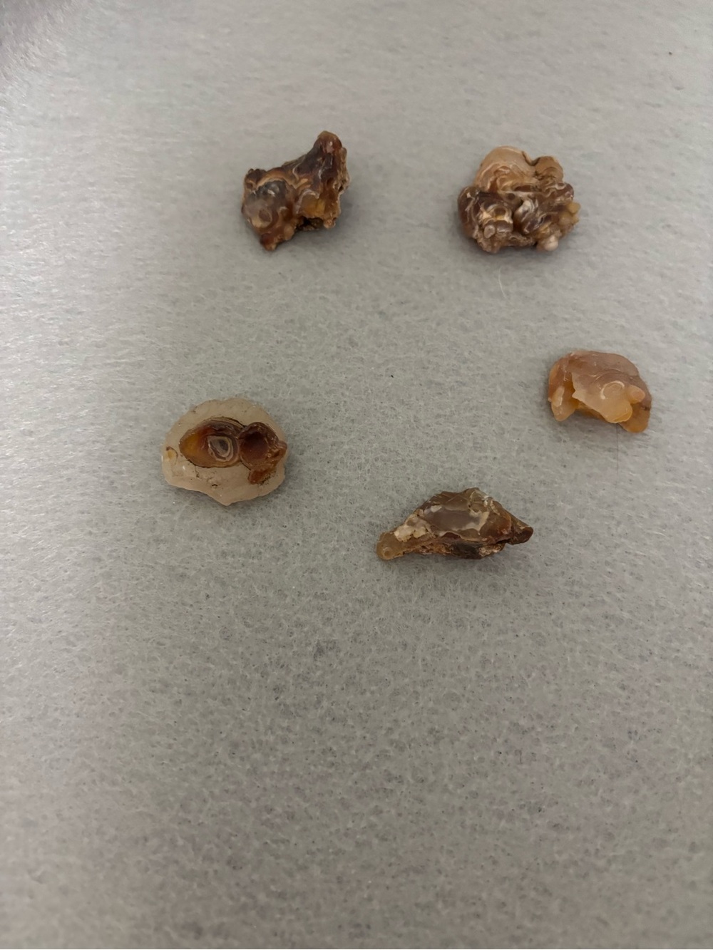 Lot of 5 Wa State Botryoidal Chalcedony/ Nodules Eyes/Agate Rough Specimens